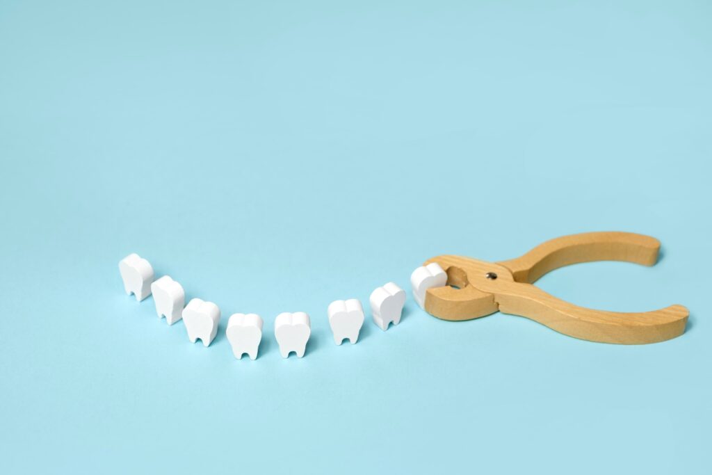 歯周病が進行して抜歯しているイメージ